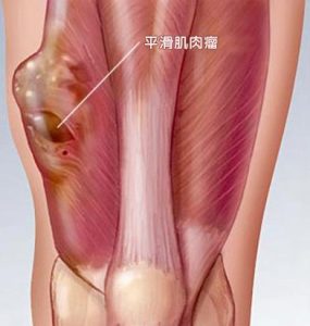 帕唑帕尼的用法用量有什么要求？